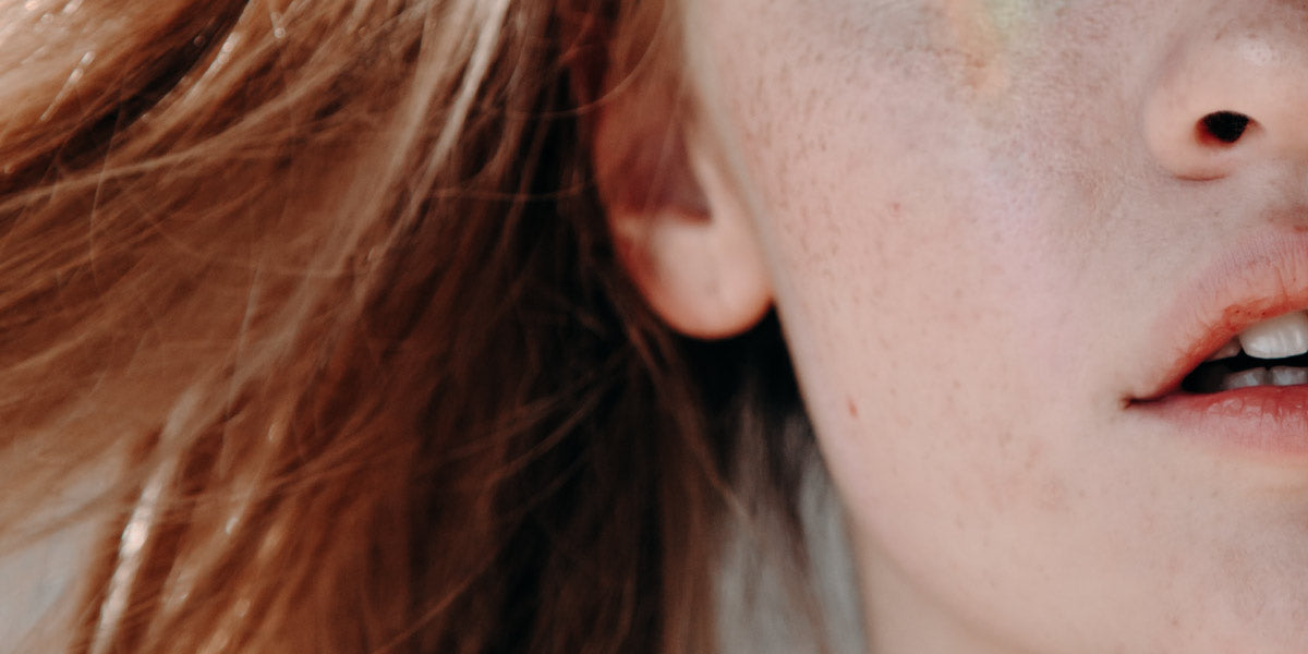 Pigmentation of Skin - Nutrova