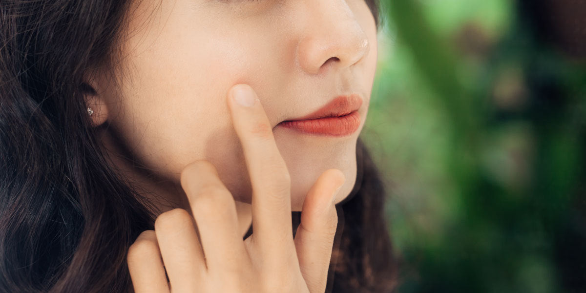 How acne forms in our skin - Nutrova