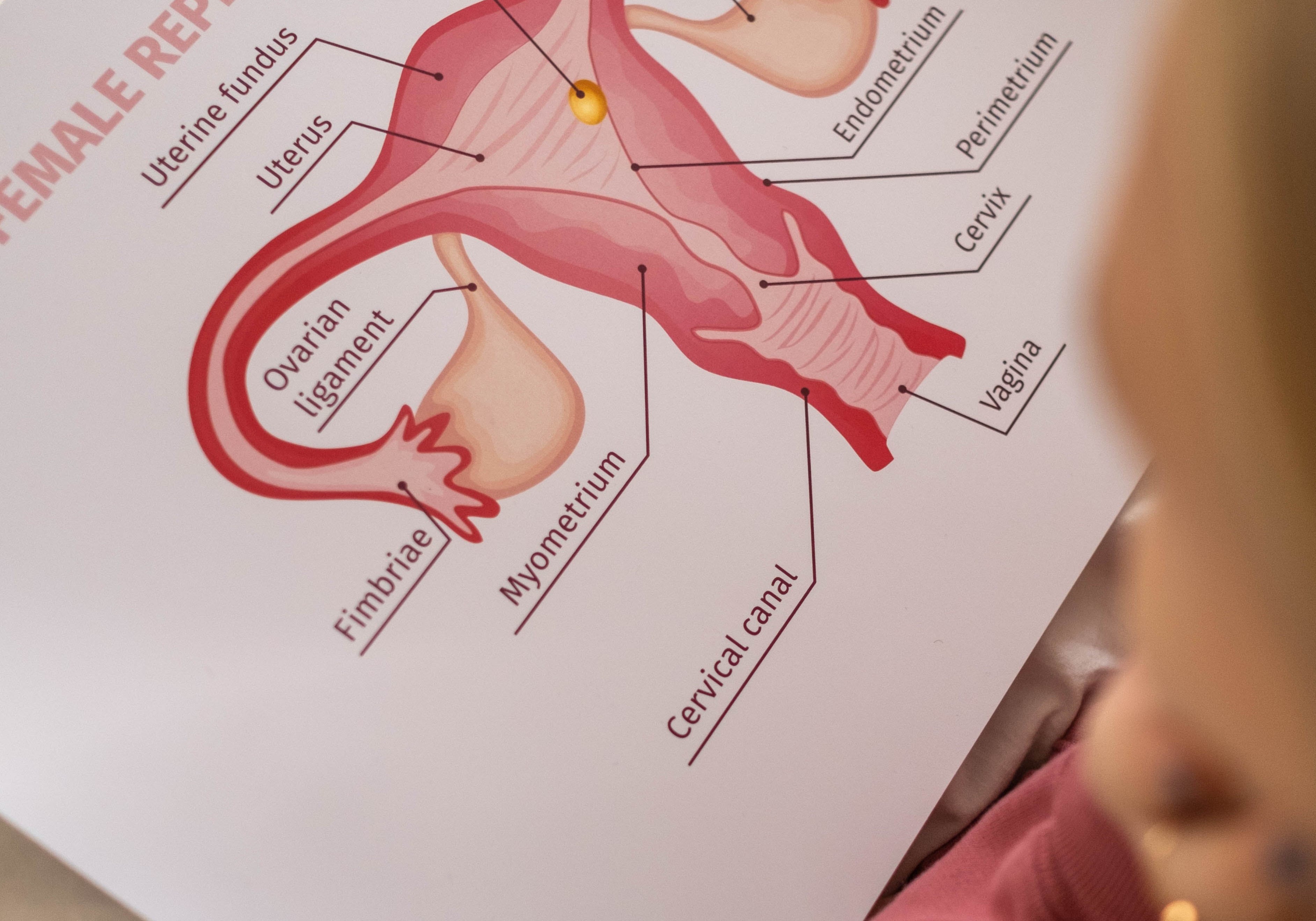 The Syndrome that is PCOS